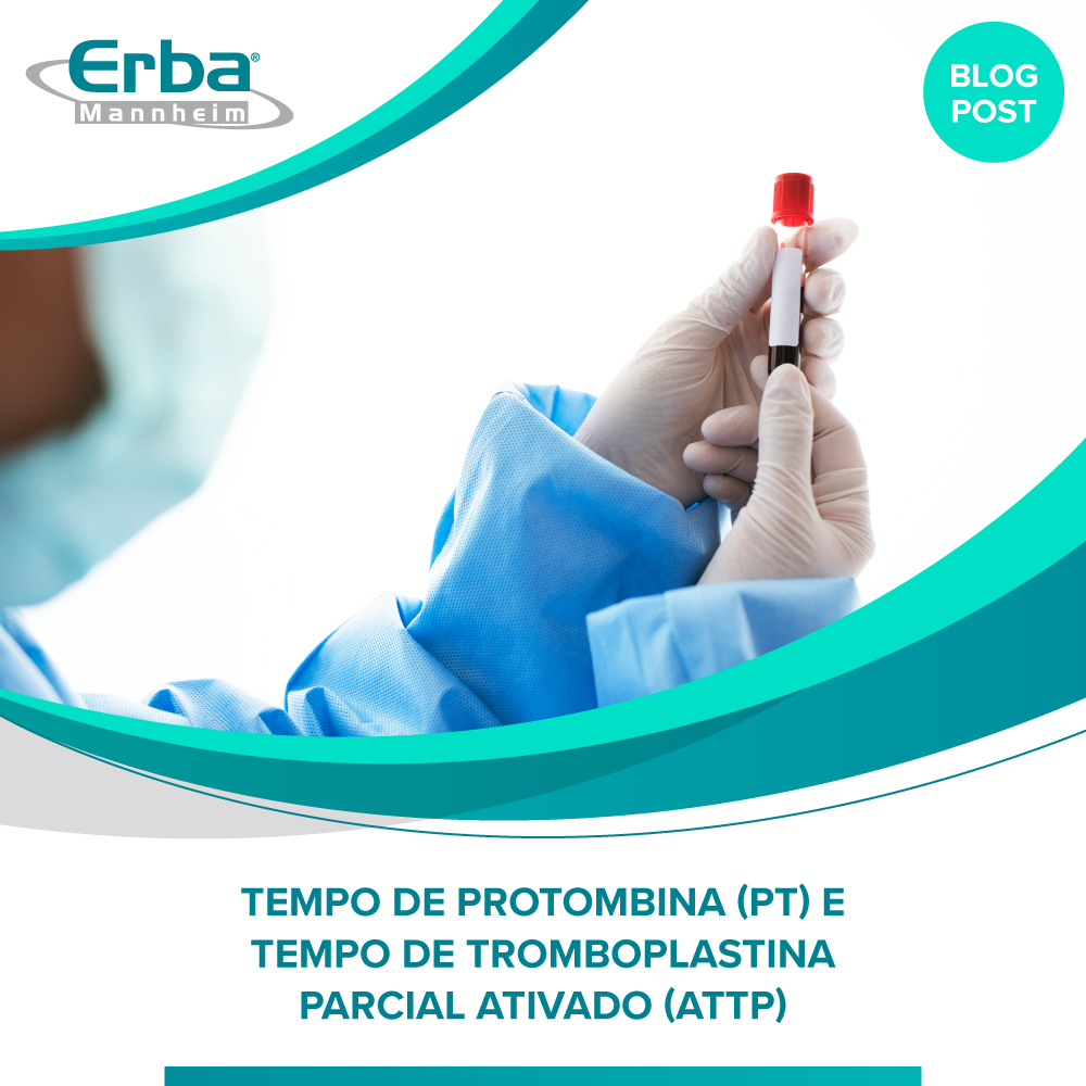 Tempo de Protombina (PT) e Tempo de Tromboplastina Parcial Ativado (aTTP)