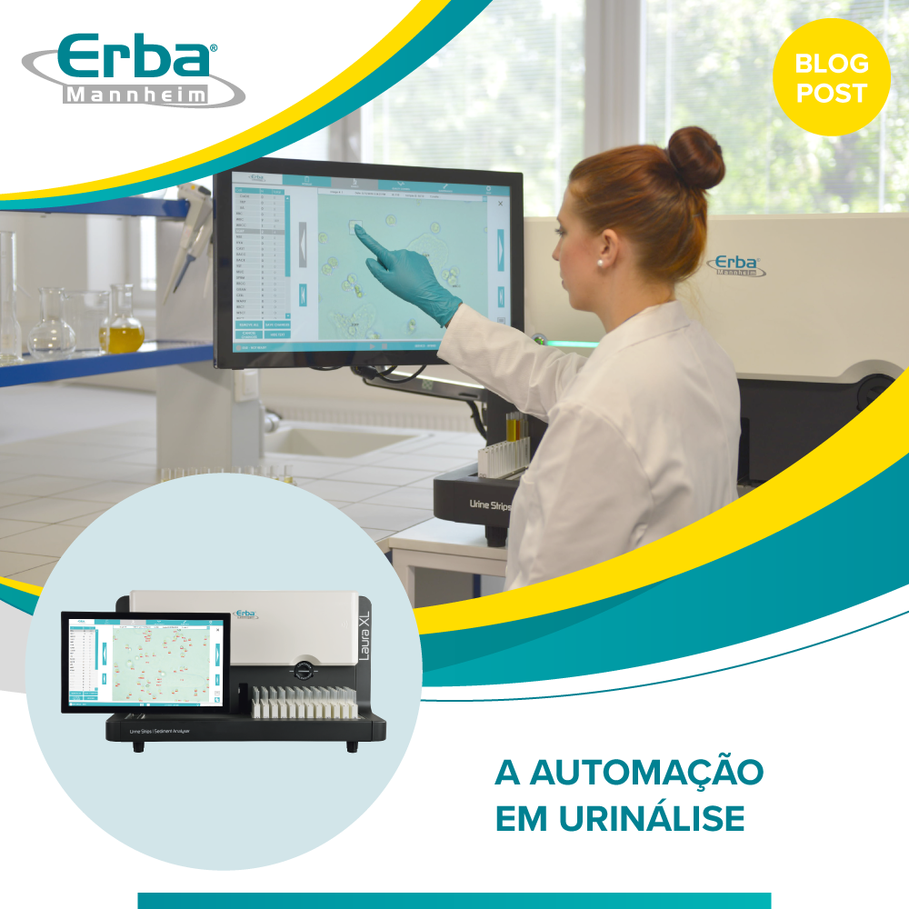 Automação em Urinálise