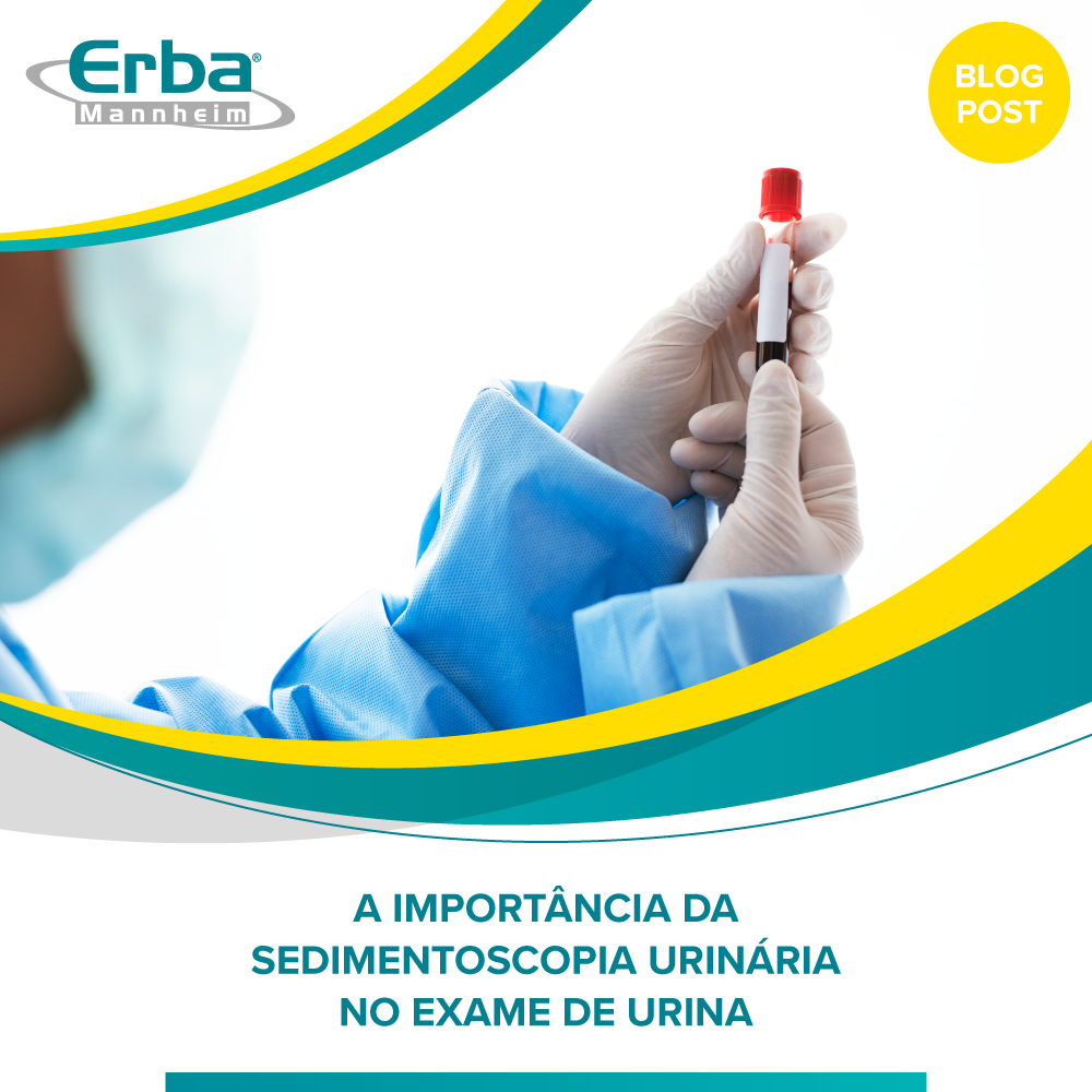 Qual é a importância da Sedimentoscopia urinária para o exame de urina?