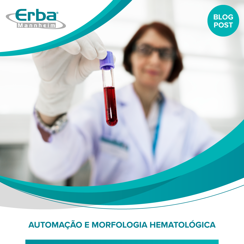 Automação e Morfologia Hematológica