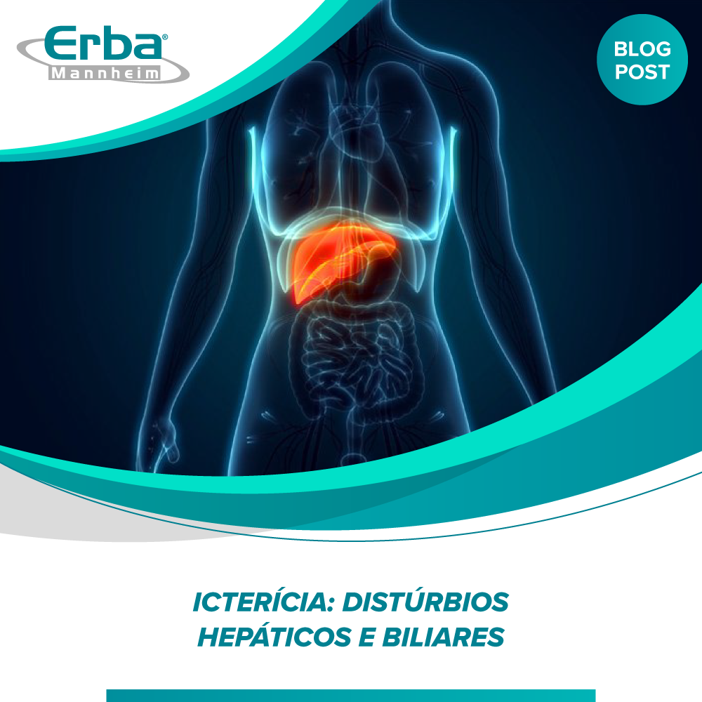 Icterícia: Distúrbios hepáticos e biliares