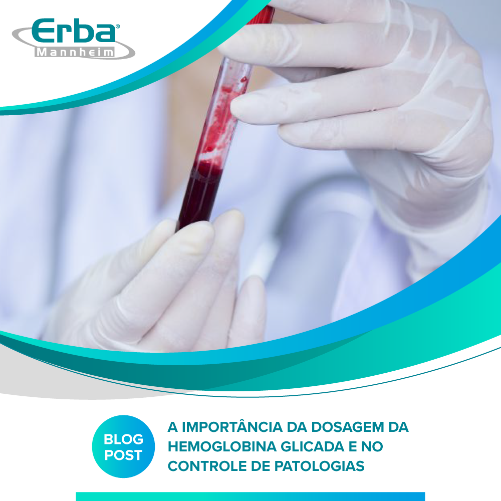A importância da dosagem da hemoglobina glicada no controle de patologias